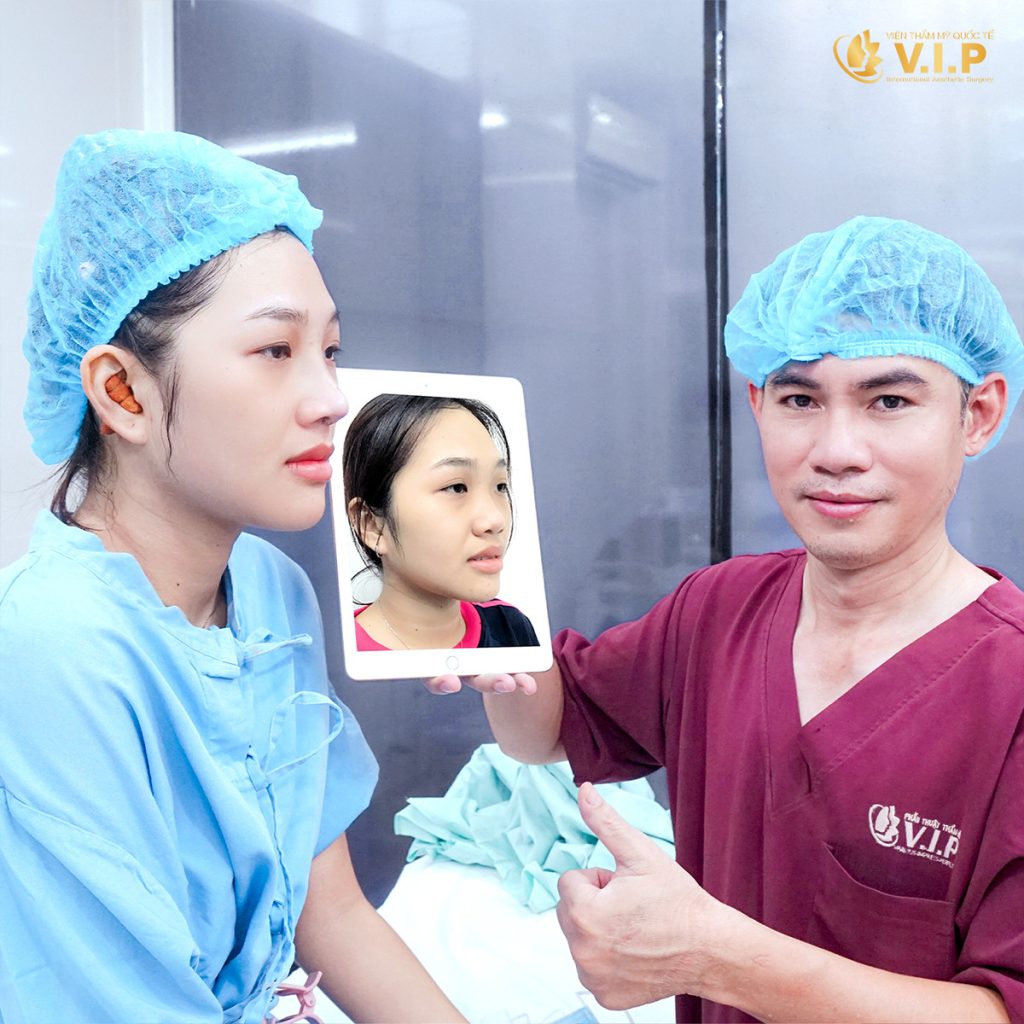nâng mũi đẹp và an toàn tại V.I.P