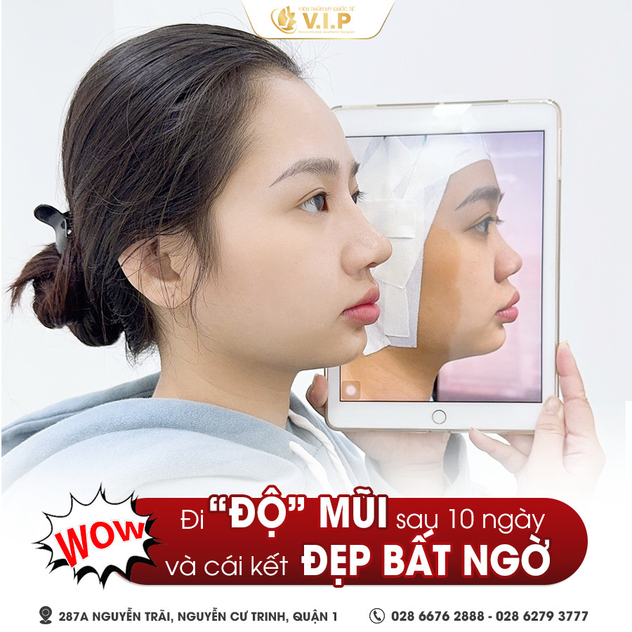 nâng mũi hàn quốc hồi phục nhanh chỉ sau 10 ngày