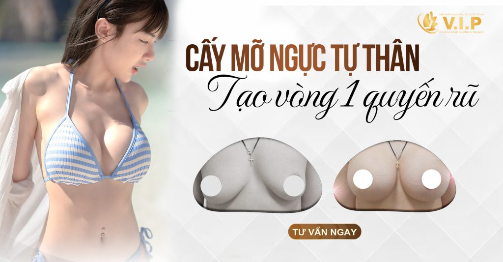 cấy mỡ ngực đẹp tự nhiên tại V.I.P