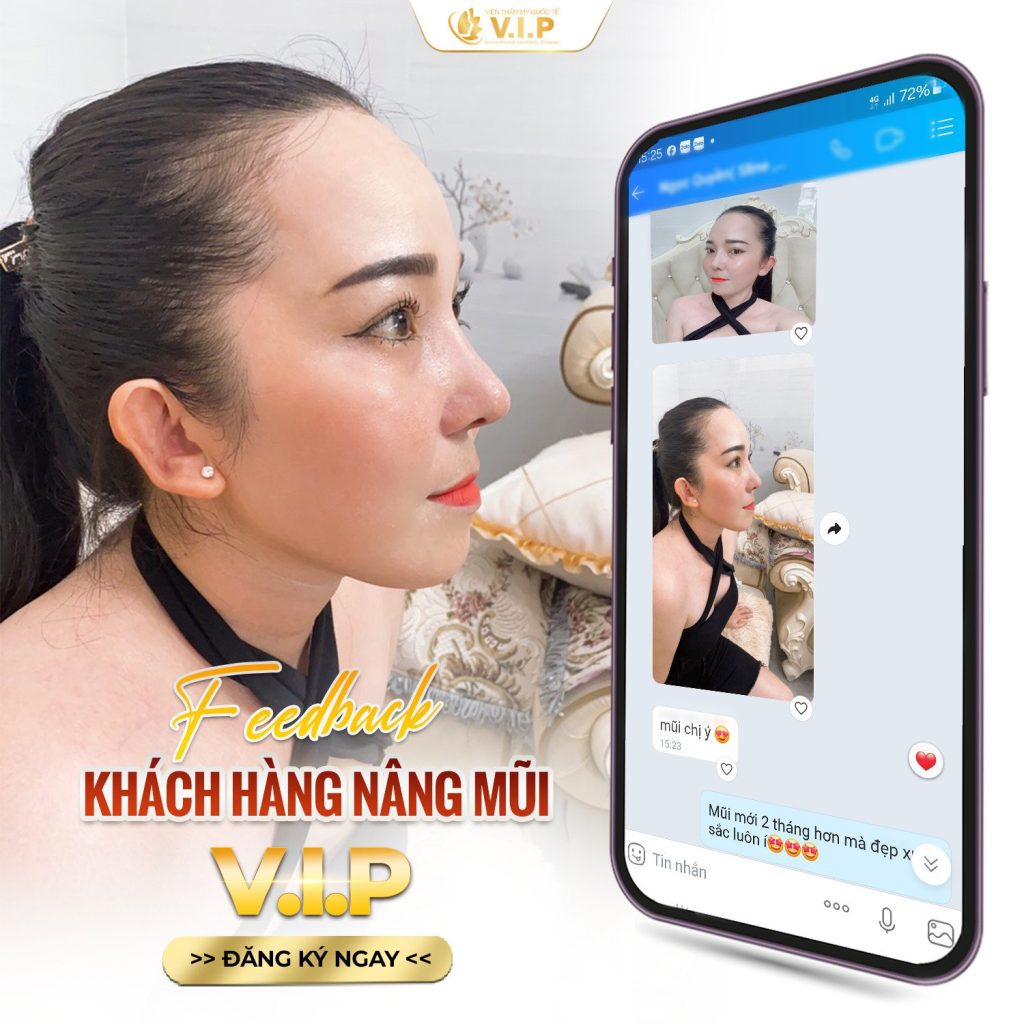 Mũi cao hợp với khuôn mặt