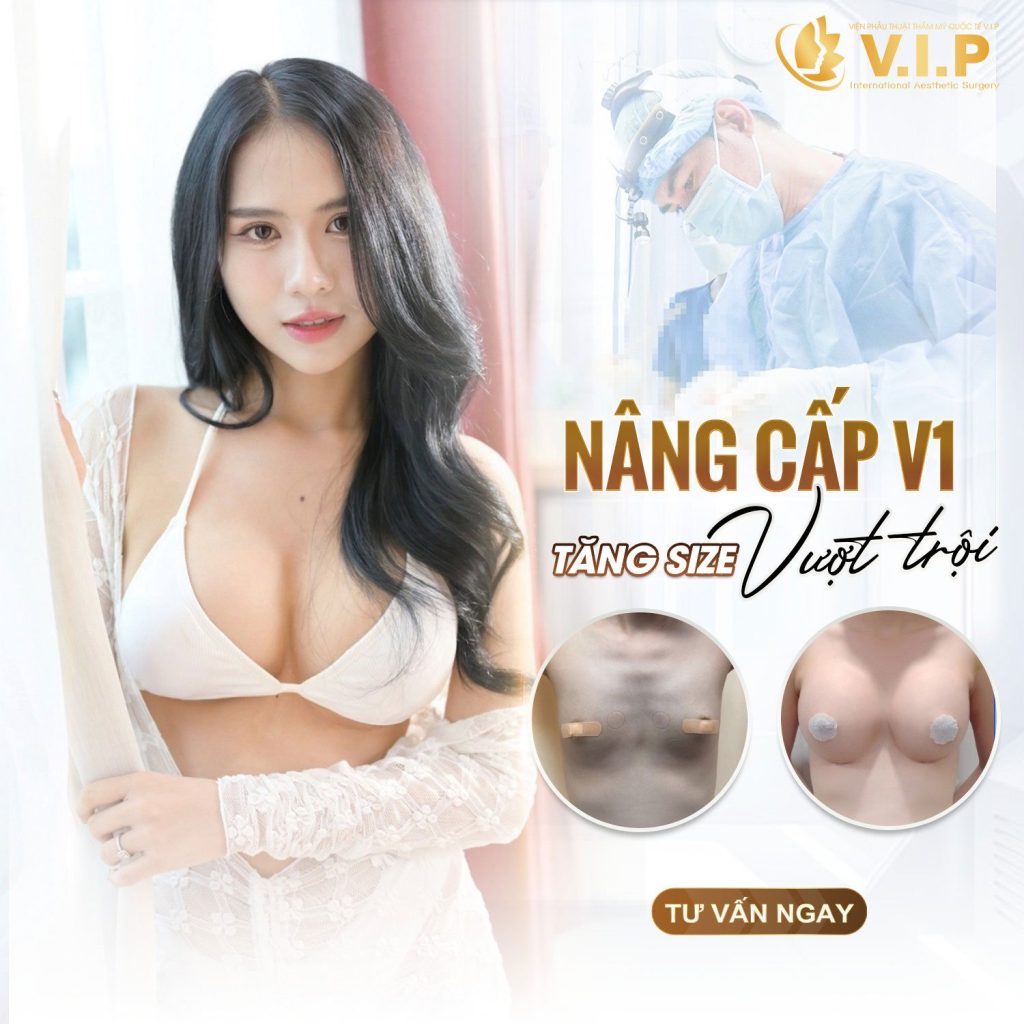 nâng cấp vòng 1 an toàn tại V.I.P