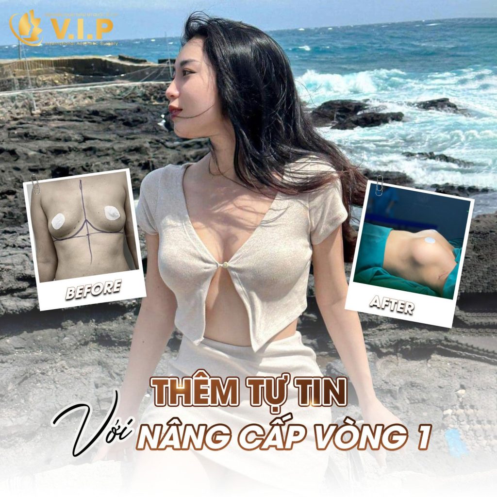 tự tin hơn sau khi nâng cấp vòng 1