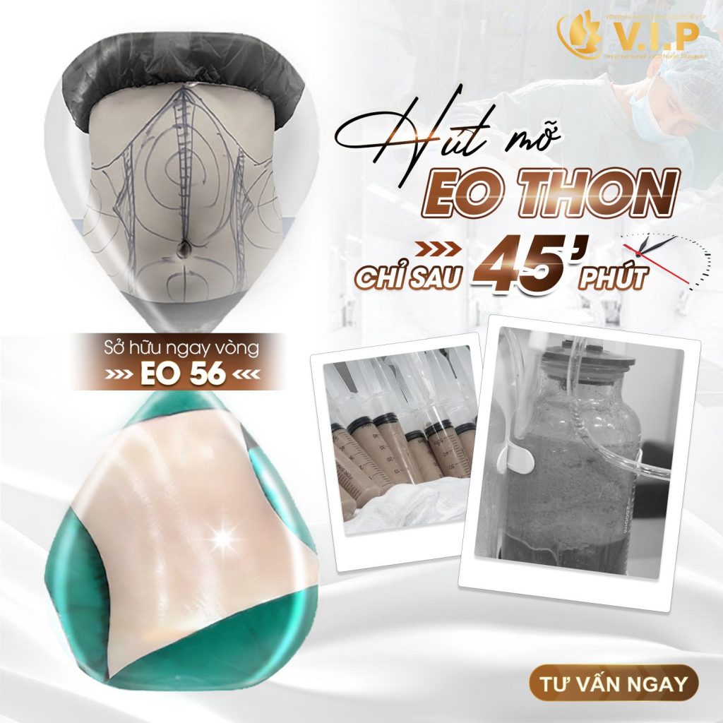 hút mỡ eo thon chỉ sau 45 phút
