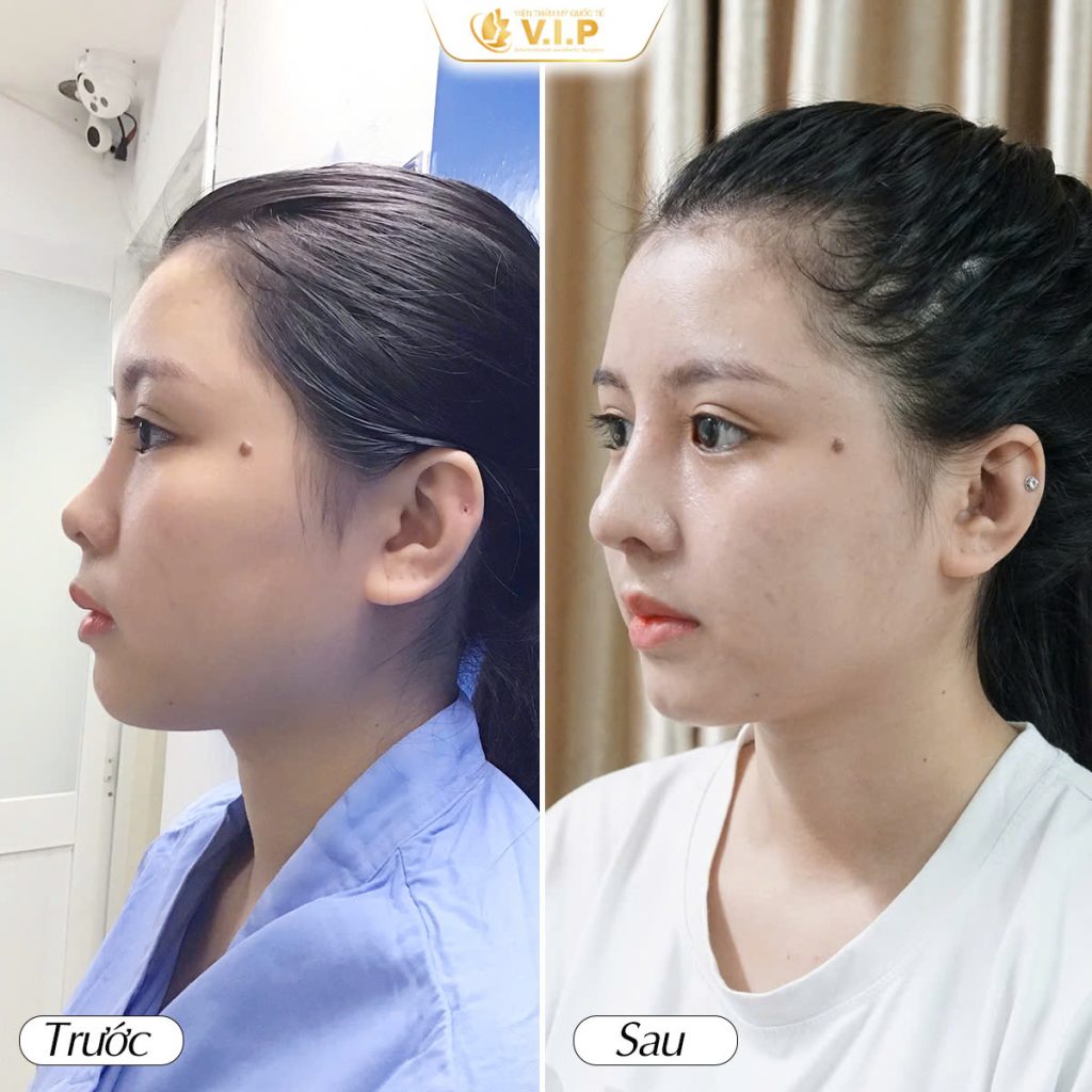 review thẩm mỹ viện V.I.P
